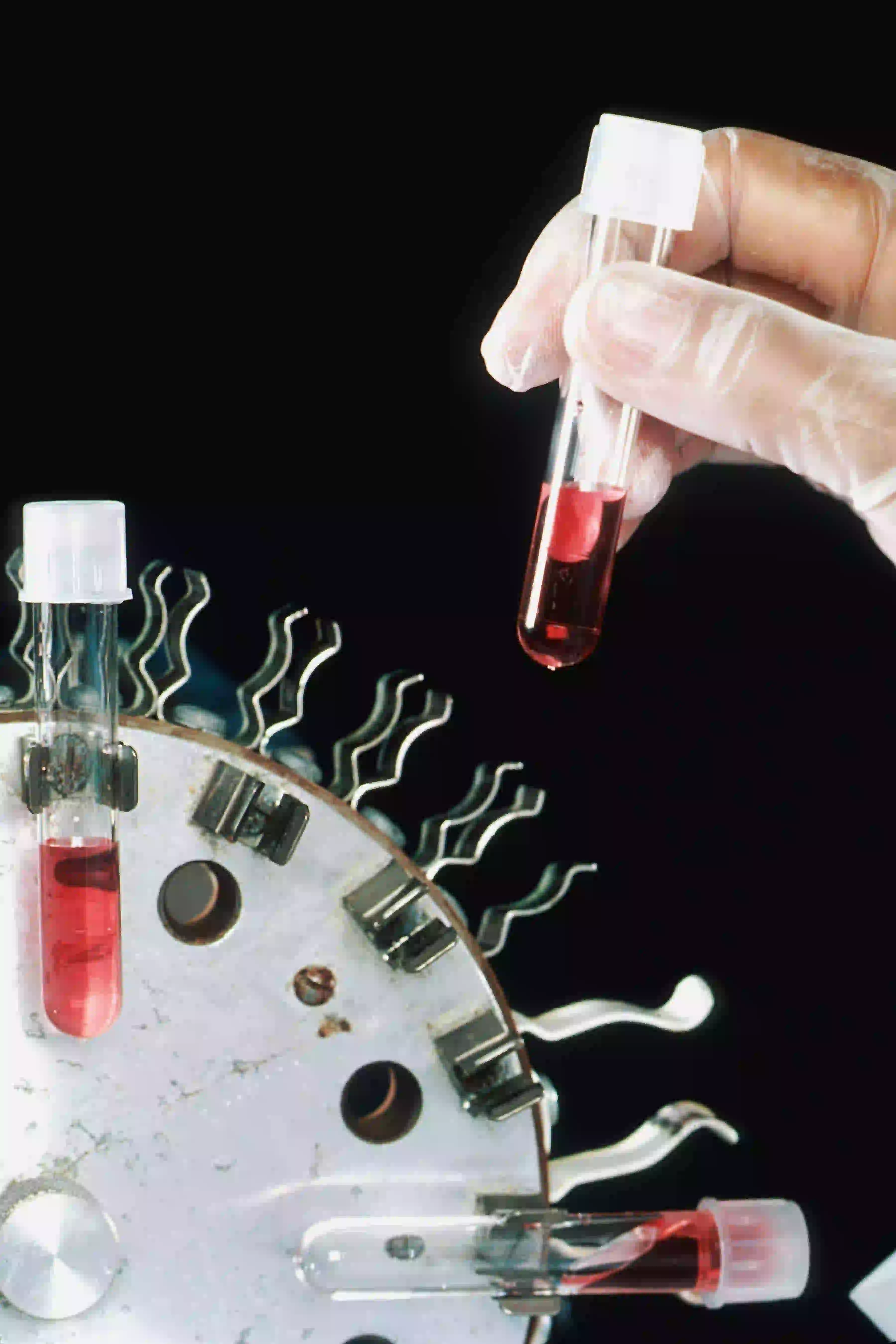 Understanding Your Blood Test Results — What All Those Numbers Actually Mean