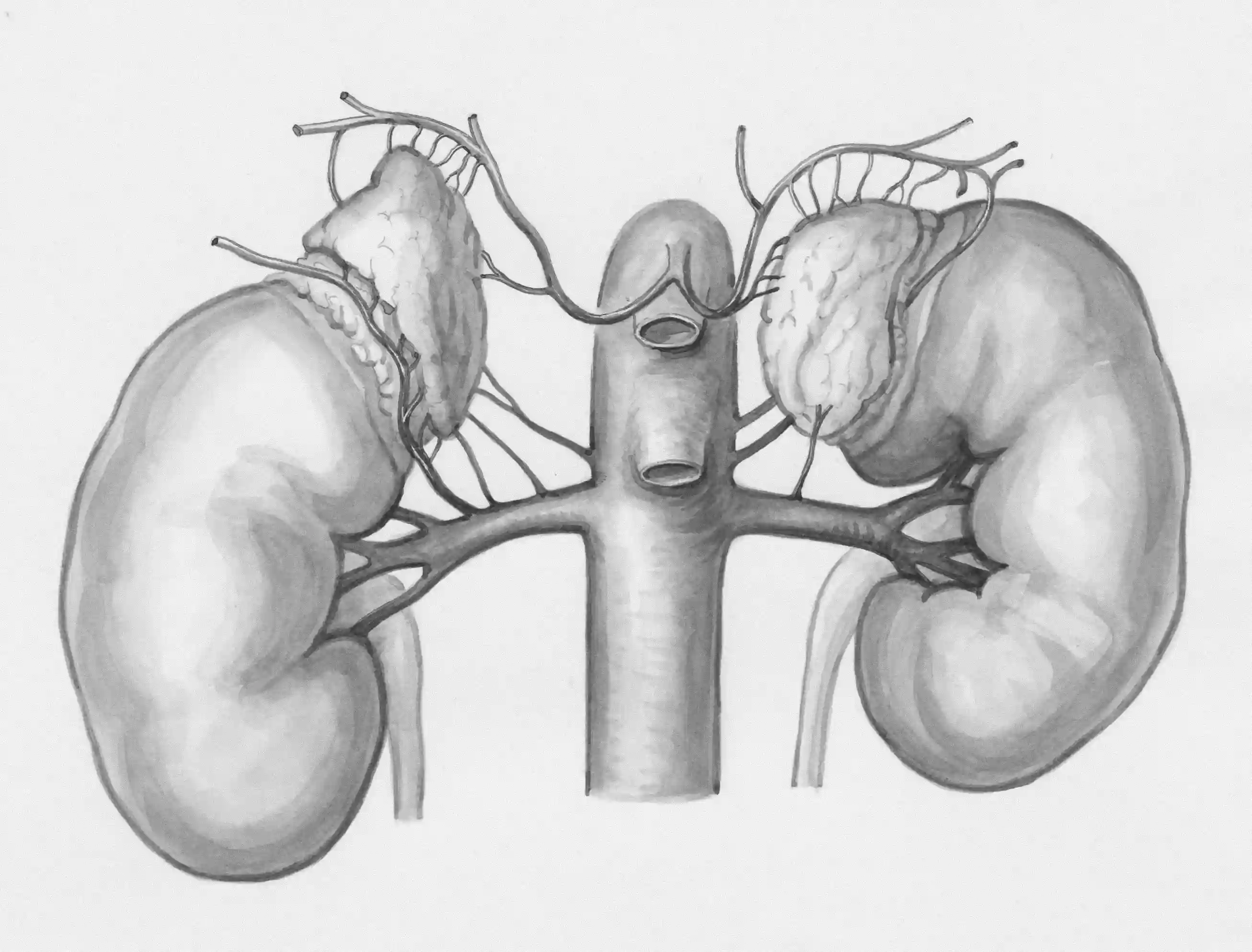 Kidney Disease — The Silent Condition Affecting Black Patients at Three Times the Rate