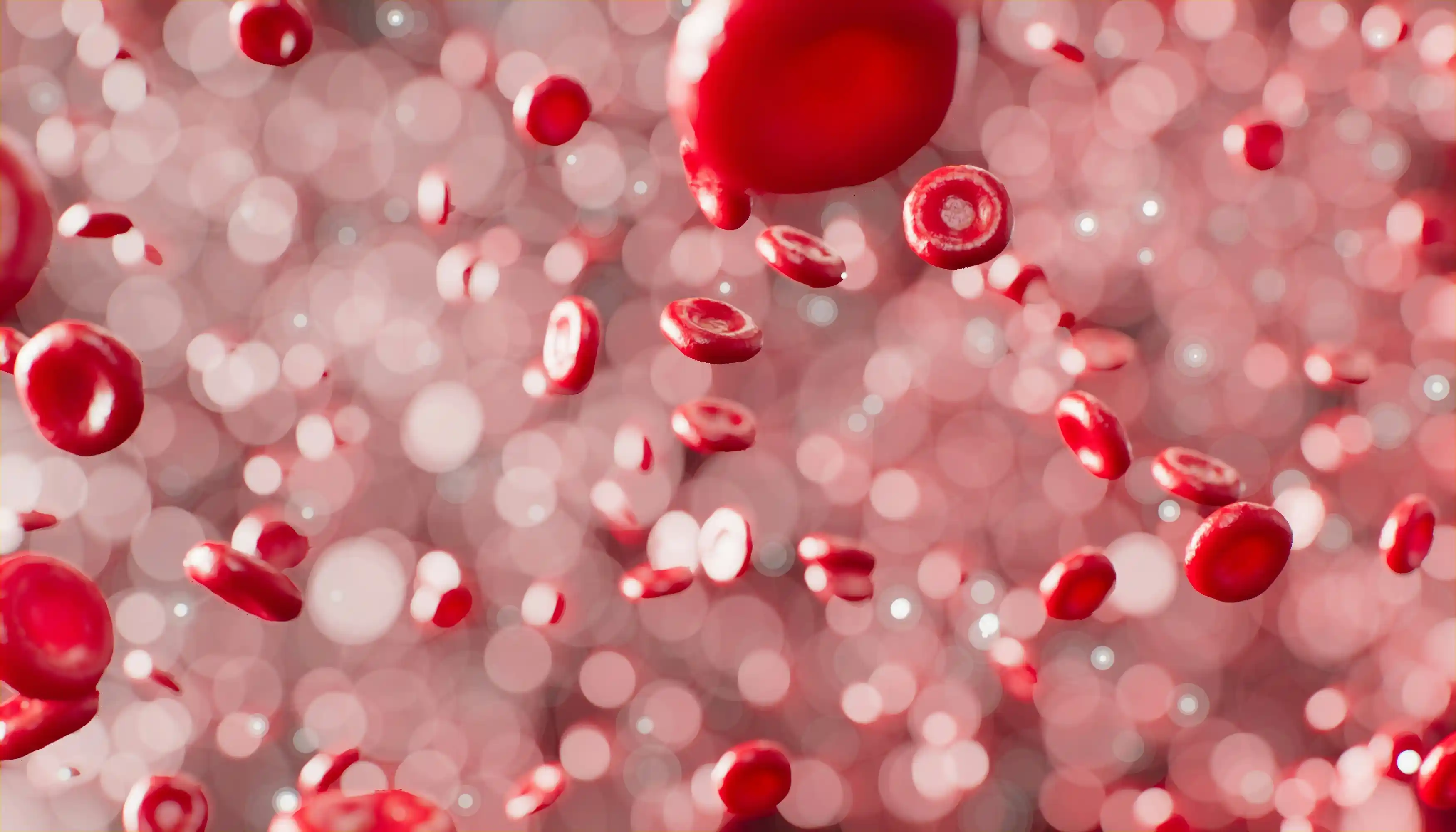 Sickle Cell Disease — A Plain-English Guide for Patients and Families
